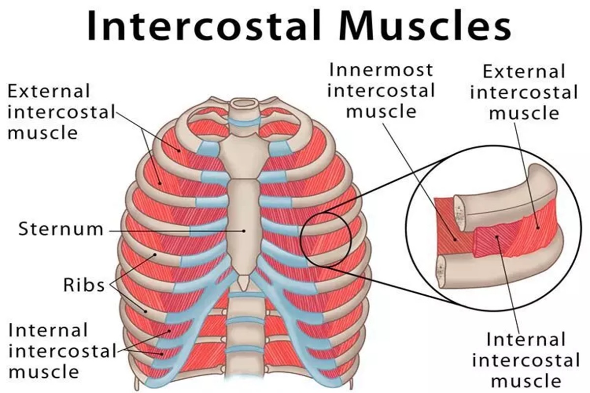 Infographic detailing symptoms, diagnosis, and recovery tips for intercostal muscle strain.