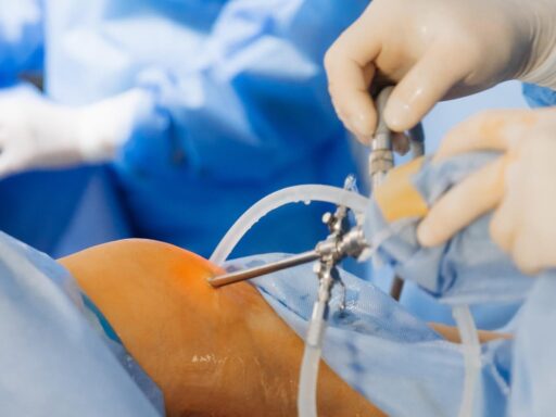 Disadvantages of Knee Replacement Surgery