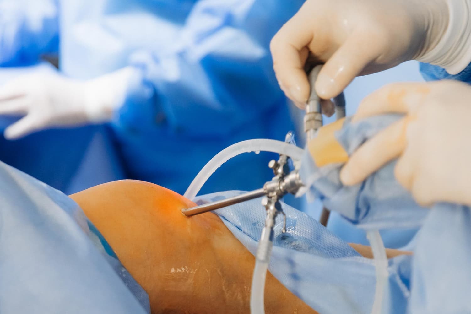 Disadvantages of Knee Replacement Surgery